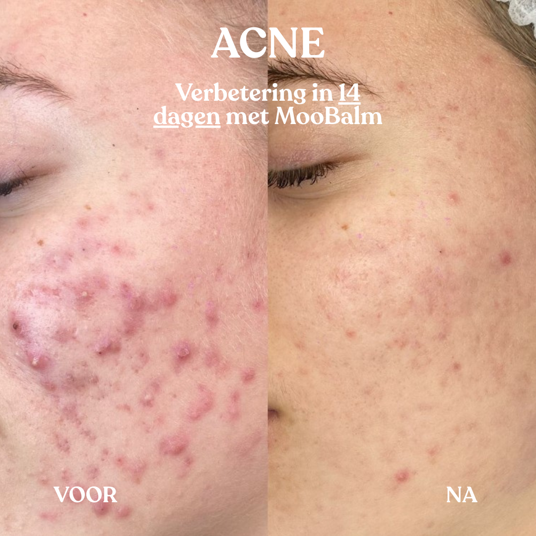 Whipped Calming Balm