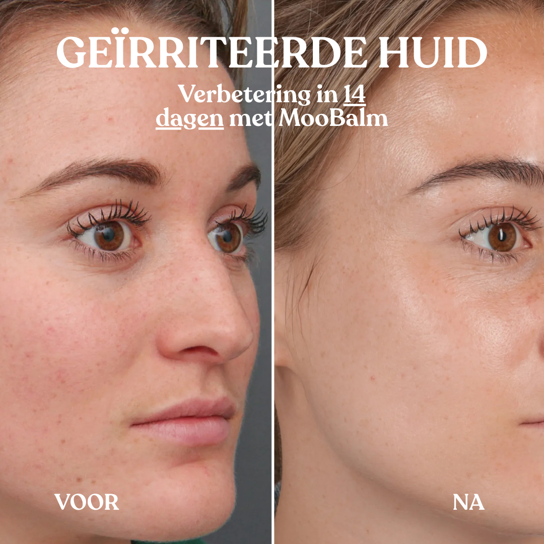 Whipped Calming Balm